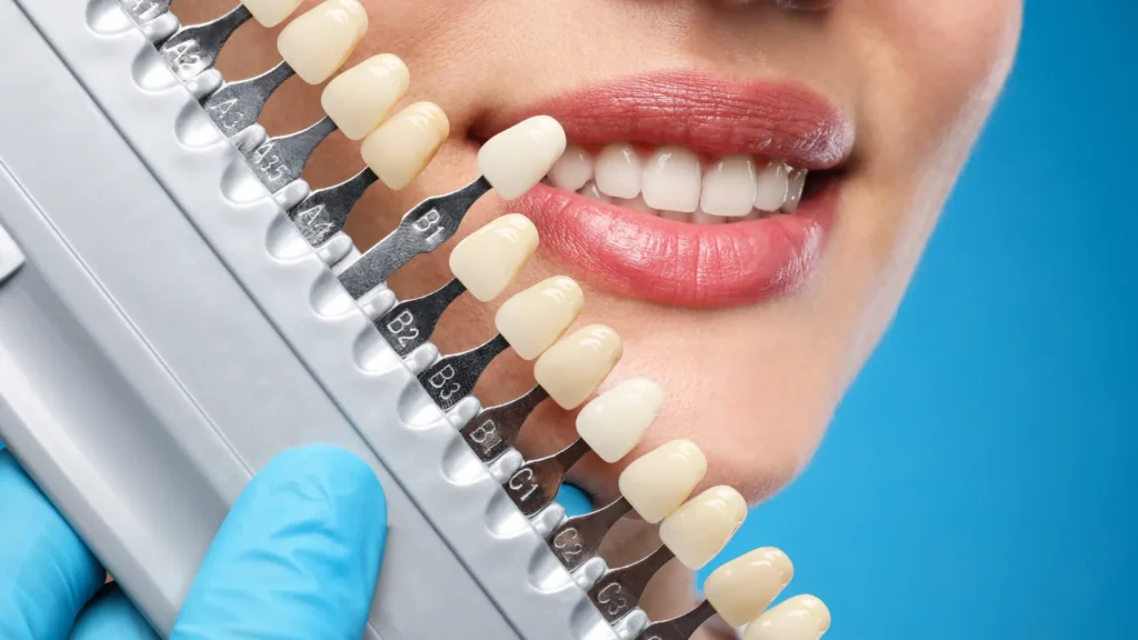 Cosmetic Dentistry in Turkey: Treatments, Costs and Smile Makeovers