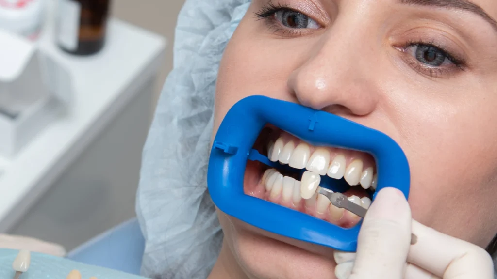 Dental Tourism in Turkey: Prices, Packages & Planning Your Trip