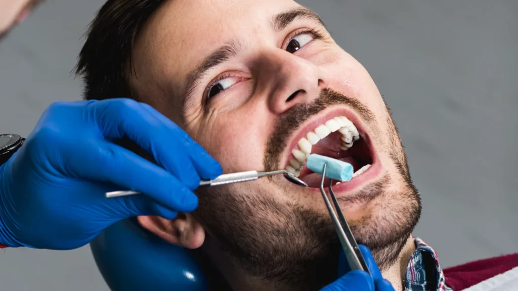 Dental Treatment in Turkey: Cost, Prices & Packages