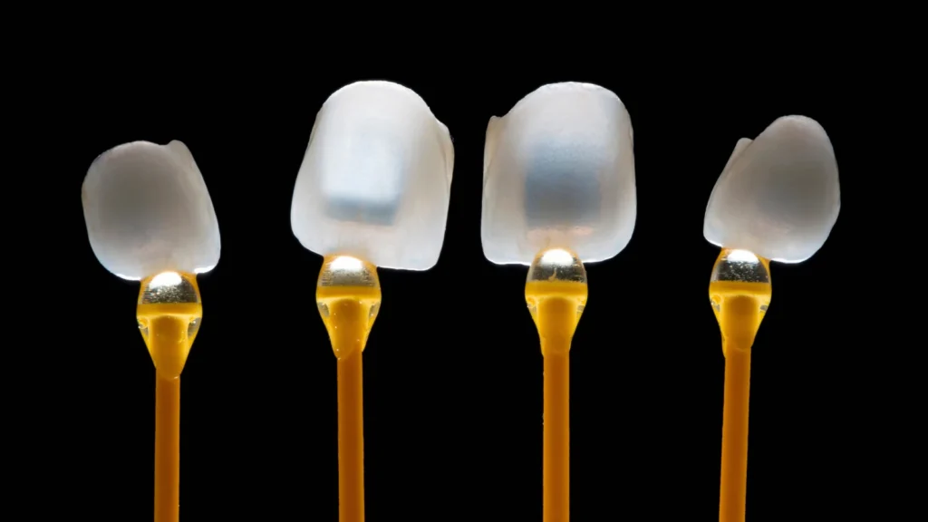 E max Veneers: Cost, Benefits, Lifespan & Treatment in Turkey