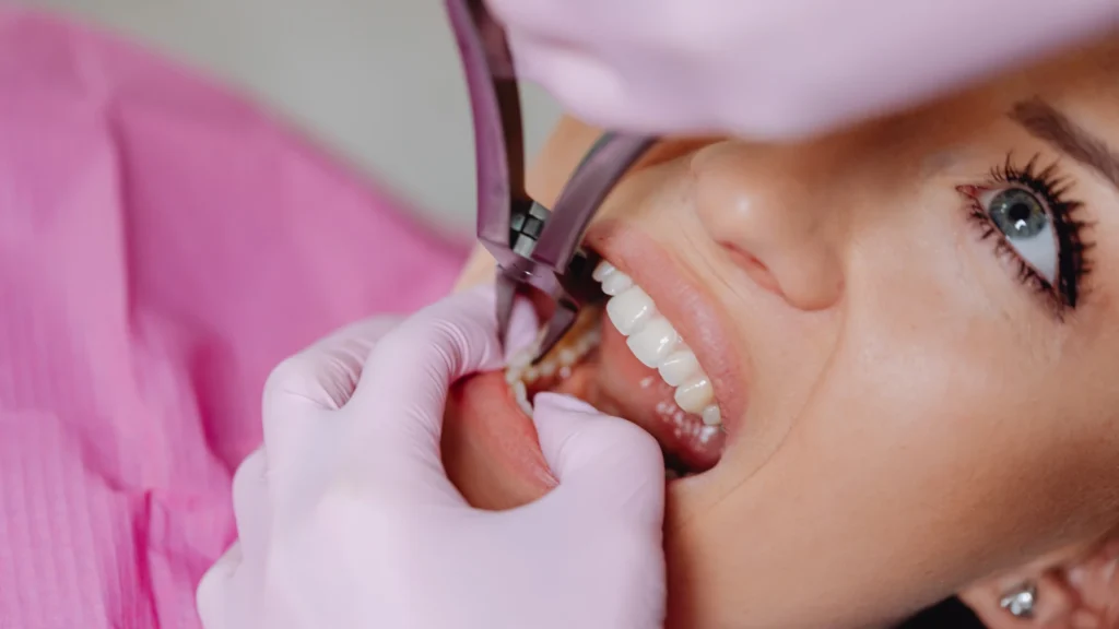 Full Mouth Dental Implants Turkey: Costs, Packages And Treatment Stages