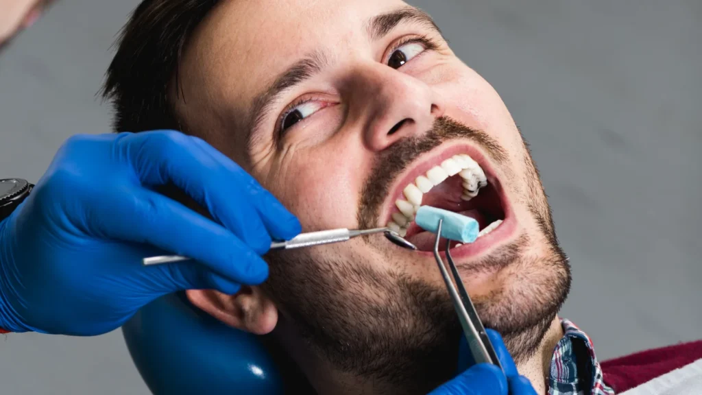How Long Should You Stay in Turkey for Dental Treatment