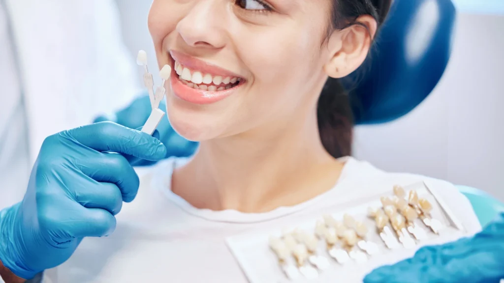 Porcelain Laminate Veneers: Cost & Treatment in Turkey