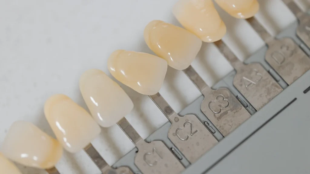 Porcelain Laminate Veneers: Cost & Treatment in Turkey