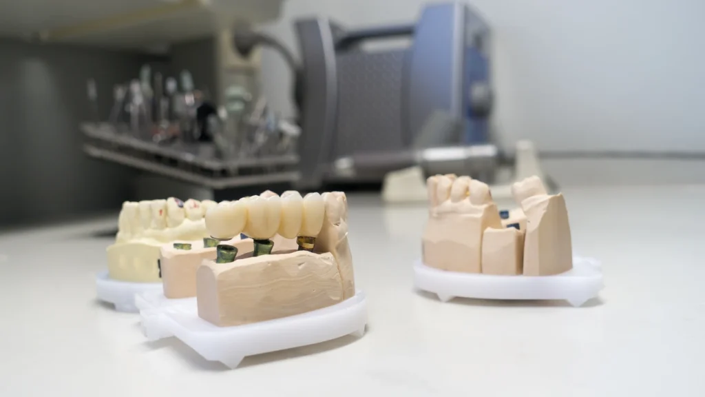 Zirconia Crowns Disadvantages: Risks, Problems & Who Should Avoid Them