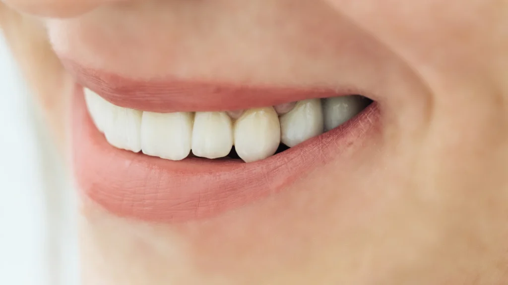 Zirconia vs Porcelain Crowns: Strength, Appearance & Lifespan